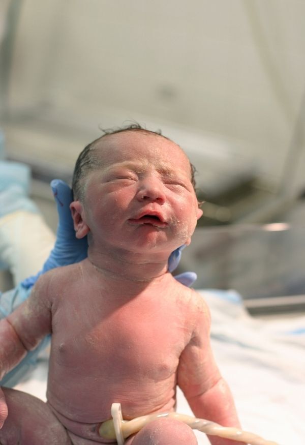 Baby with umbilical cord